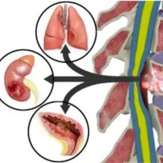 2025 EEH: Neuroscience Grand Rounds Enduring: The Multidisciplinary Management of Spinal Metastasis Banner